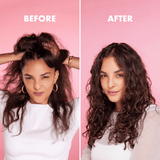 Scalp Restore Starter Kit